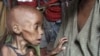 UN World Food Security Committee Meets in Rome