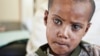 A young Ethiopian patient with cataract waits to be examined at the Quiha Eye Hospital Vision Center in Mekelle, Ethiopia