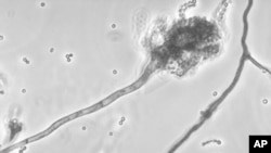 Le fungus Aspergillus fumigatus qui serait responsable de l'épidémie de méningite aux Etats-Unis