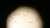 Schistosoma mansoni worms, the cause of schistosomiasis, a microscopic worm that claims claims 200,000 lives per year, seen through a microscope. 
