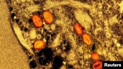 FILE - Colorized transmission electron micrograph of mpox virus particles captured at the NIAID Integrated Research Facility in Fort Detrick