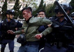 FILE - An unidentified man is escorted by riot police at Mong Kok in Hong Kong, Feb. 9, 2016.