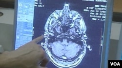 Los científicos creen que es cuestión de tiempo antes para trazar los circuitos cerebrales implicados en el habla consciente.