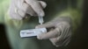 Početak korištenja antigenskih testova u FBiH: O kakvim se testovima radi?