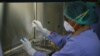 Obat Transplantasi Mungkin Bisa Atasi HIV