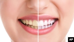teeth whitining