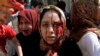 سازمان ملل: صدای قربانیان سوری در گرماگرم خشونت‌ها به گوش نمی‌رسد 