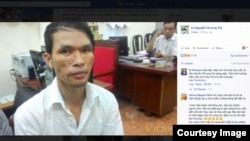 ​​​បុរស​ជនជាតិ​វៀតណាម​​ ​ឈ្មោះ​ ​ង្វៀន ថាញ់ឌុញ​ ​(Nguyen Thanh Dung) ​វ័យ​២៥ឆ្នាំ​ដែល​សង្ស័យ​ ​ថា​បាន​ធ្វើ​ទារុណកម្ម​លើ​ក្មេង​ប្រុស​កម្ពុជា​អាយុ​២ឆ្នាំ​ ​នៅ​ក្នុង​ខេត្ត​មណ្ឌលគិរី​ ​ត្រូវ​បាន​ចាប់ឃាត់​​ខ្លួន​ដោយ​អជ្ញាធរ​វៀតណាម​កាល​ពី​យប់​ថ្ងៃ​ពុធ​ទី​ ០៧ខែធ្នូឆ្នាំ២០១៦។​ (រូបភាពពីហ្វេសប៊ុក/VOA)