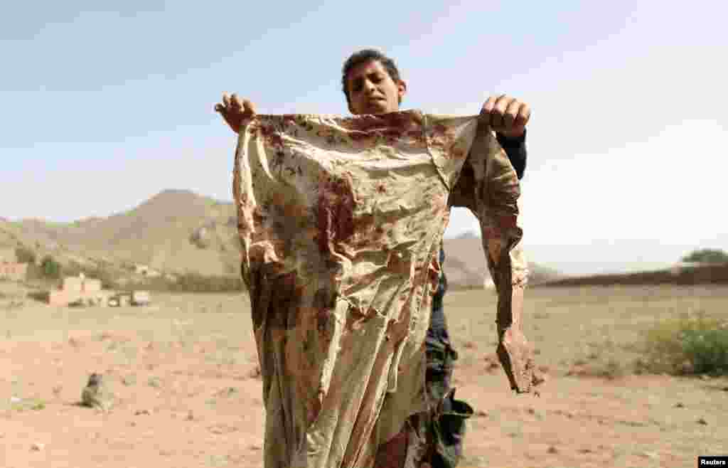 A boy holds a blood-stained garment at the site of an airstrike on a house, in Bait Rejal village, west of Sana'a, April 7, 2015.